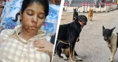 21 Year Old College Student Attacked by Stray Dogs in Kanpur