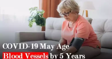 COVID-19 May Age Blood Vessels by 5 Years